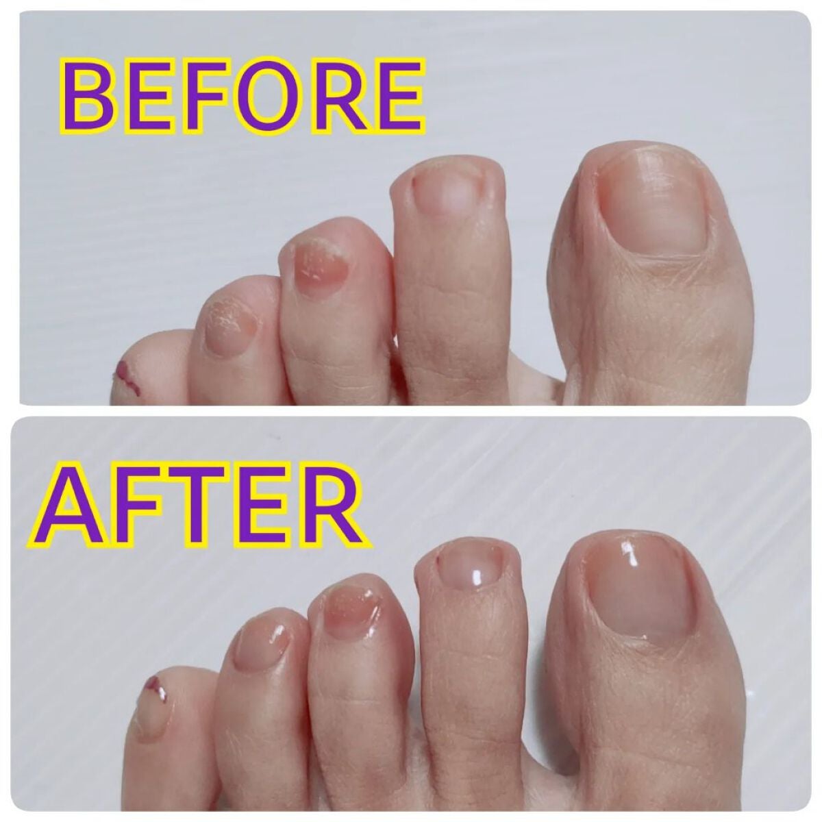 グロスフォーユアネイル/プレビュート/オールインワンネイルを使ったクチコミ(3枚目)