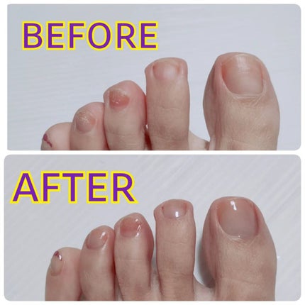 グロスフォーユアネイル/プレビュート/オールインワンネイルを使ったクチコミ(3枚目)