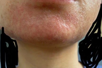 化粧水・敏感肌用・高保湿タイプ/無印良品/化粧水を使ったクチコミ(2枚目)