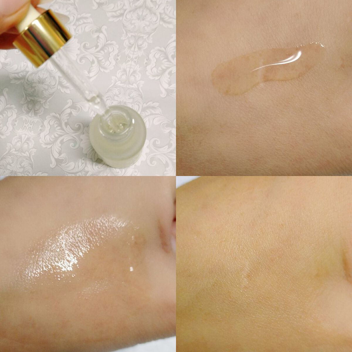 ビセットクリア/BISET/美容液を使ったクチコミ（3枚目）