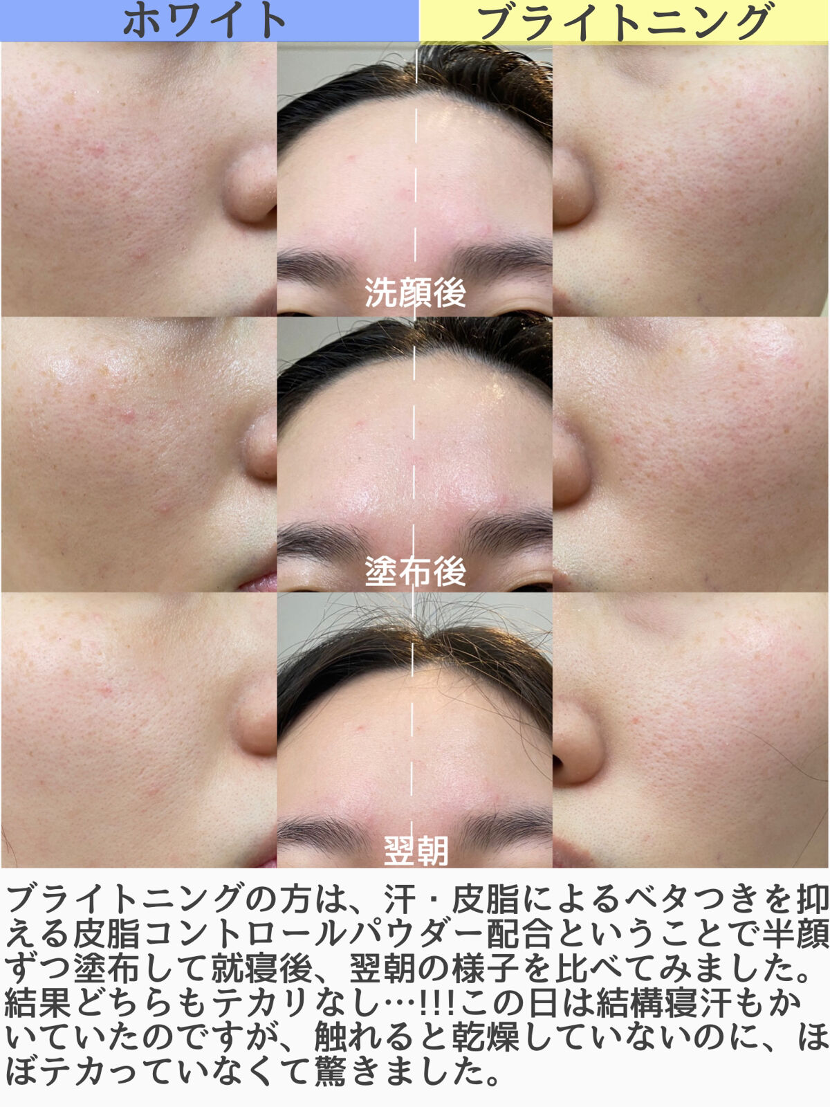 スペシャルジェルクリーム（ブライトニング） O/アクアレーベル/オールインワン化粧品を使ったクチコミ（3枚目）