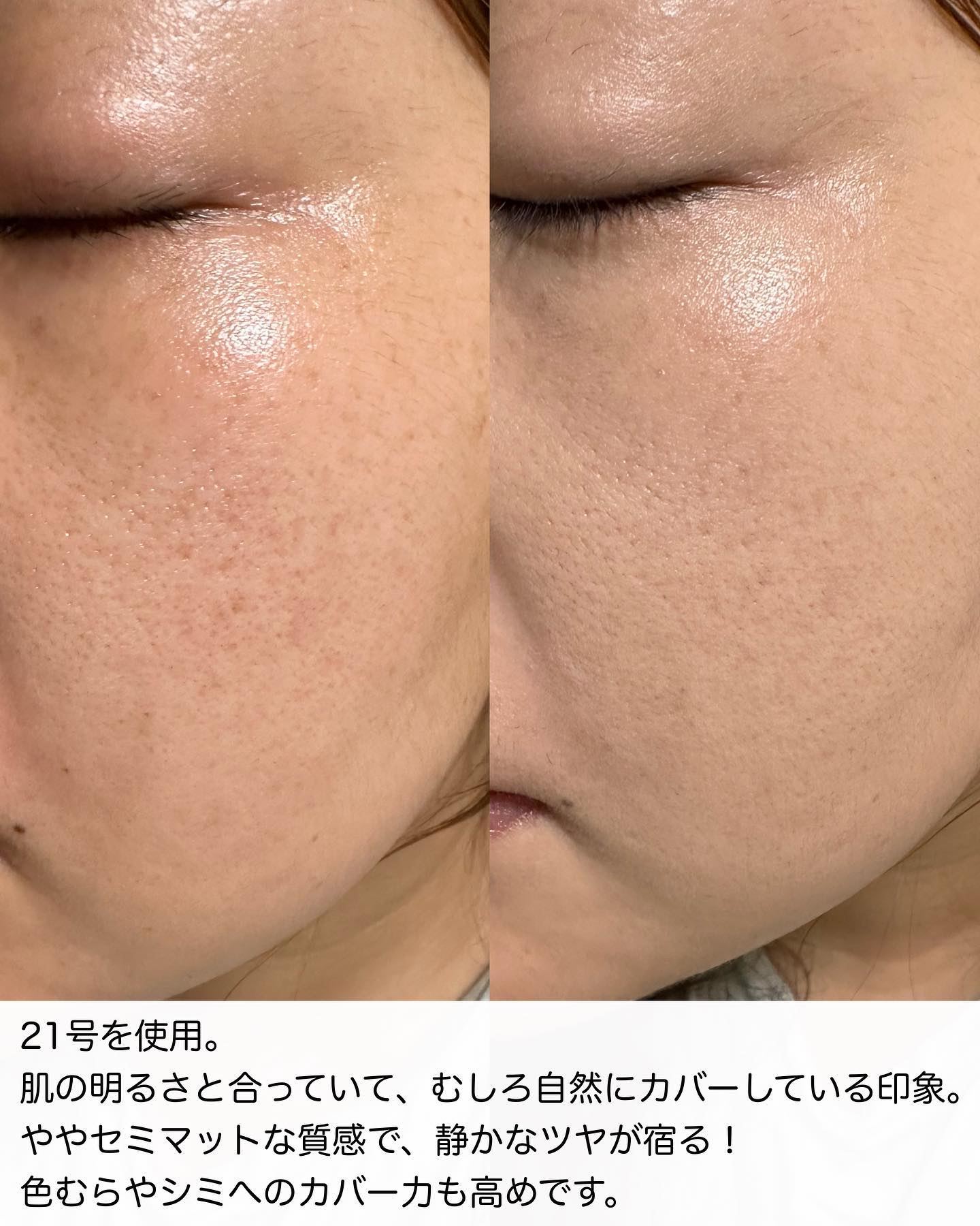 ダーマシンコンシーラー/23years old/リキッドコンシーラーを使ったクチコミ（3枚目）