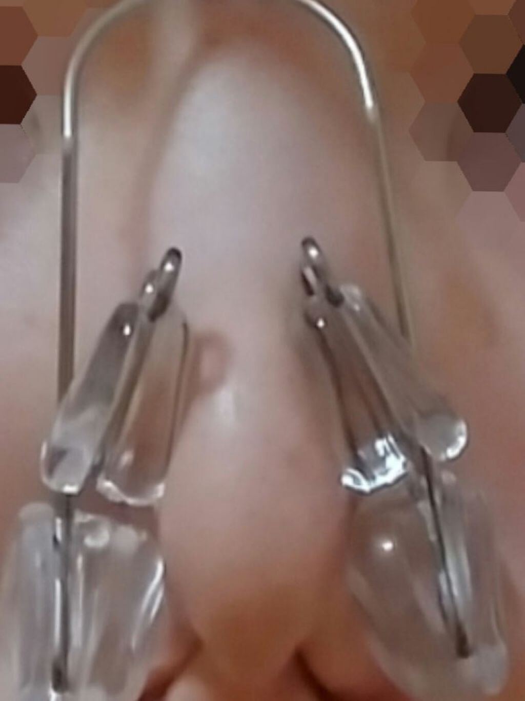 らん on LIPS 「鼻クリップの記録日記💭こんにちは!鼻がコンプレックスで整形を考..」(4枚目)