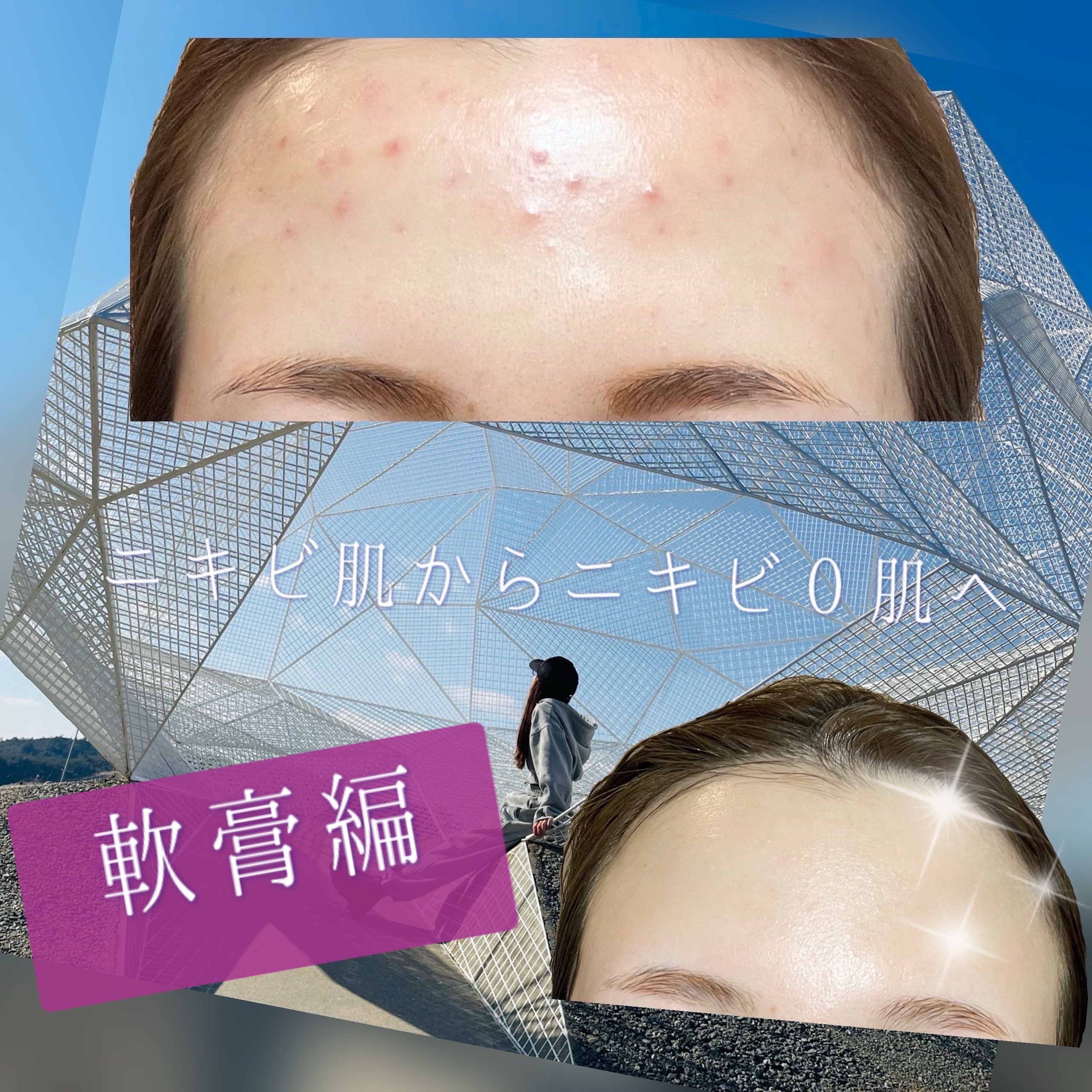 DRX AZAクリア/ロート製薬/その他スキンケアを使ったクチコミ（1枚目）