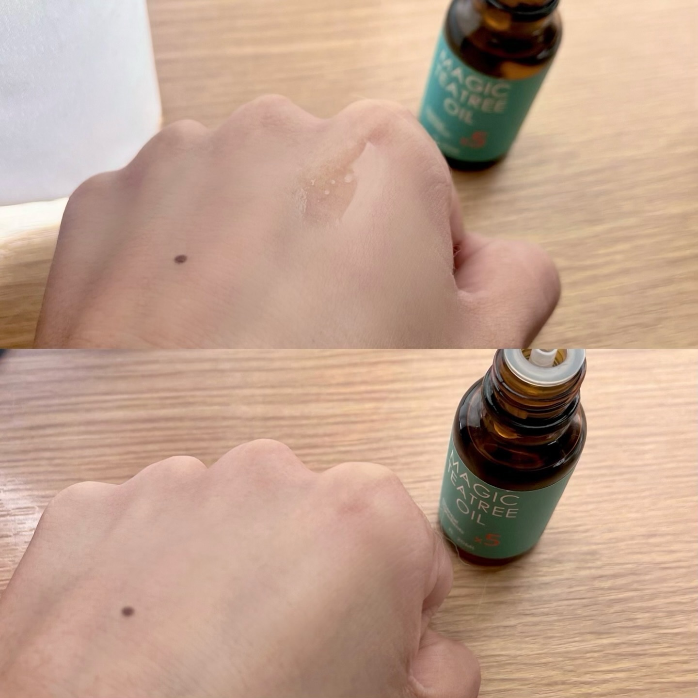 マジックティーツリーオイル/ブラン/フェイスオイルを使ったクチコミ（2枚目）