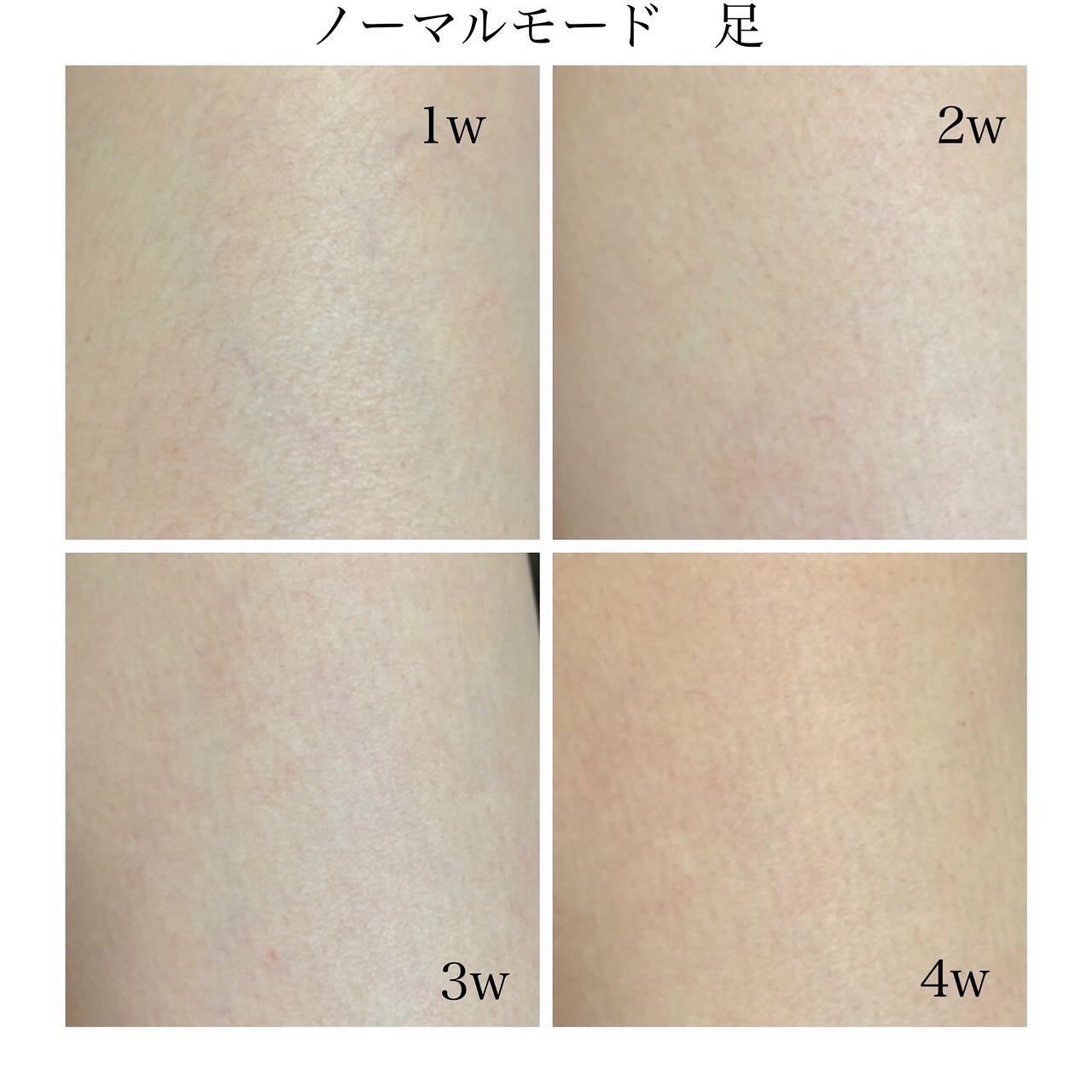 MiRAY/MYTREX/美顔器・マッサージを使ったクチコミ(4枚目)