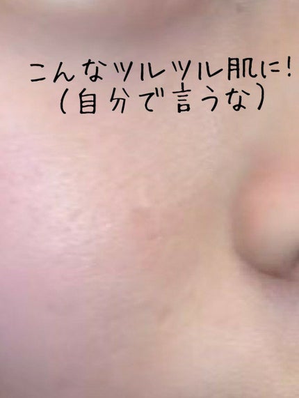 明色美顔水 薬用化粧水/美顔/化粧水を使ったクチコミ(3枚目)