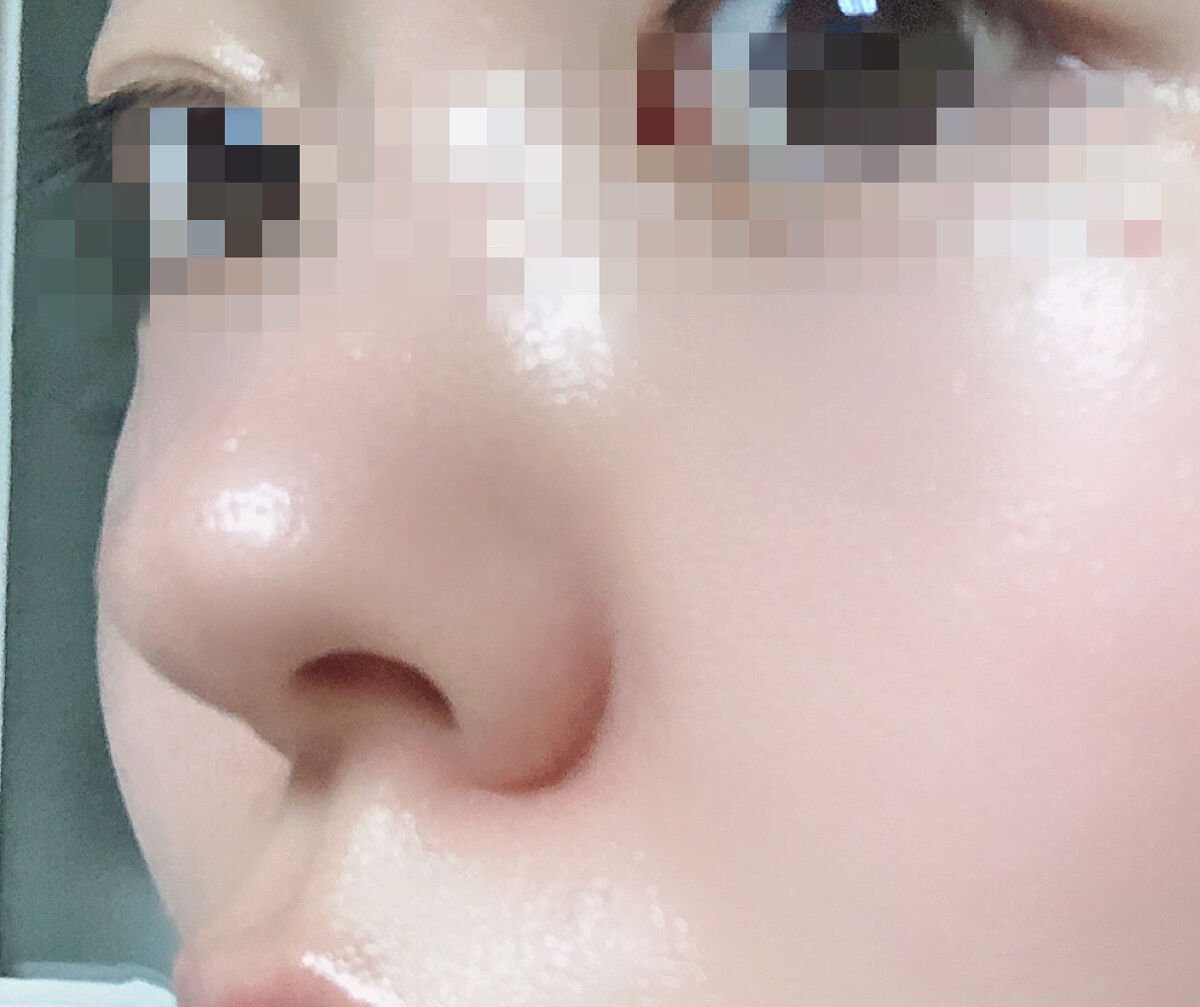 レチノール エキスパート0.1%/IOPE/美容液を使ったクチコミ（3枚目）