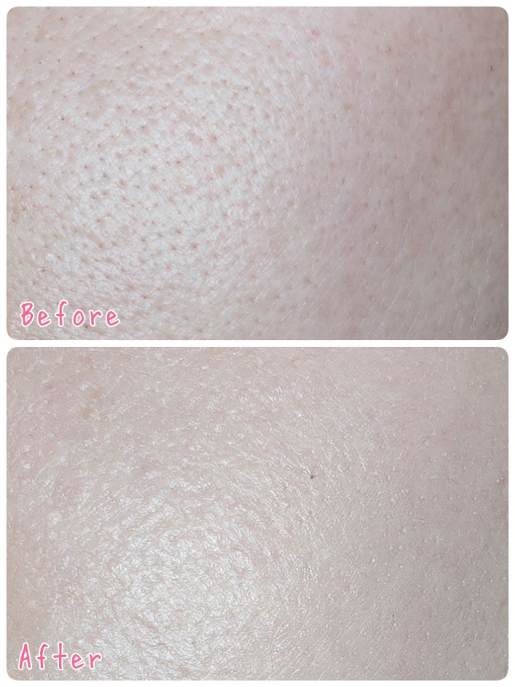 ドクタージャルト シカペア リカバー (第2世代)/Dr.Jart+/フェイスクリームを使ったクチコミ(3枚目)