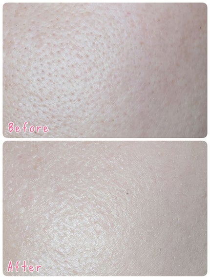 ドクタージャルト シカペア リカバー (第2世代)/Dr.Jart+/フェイスクリームを使ったクチコミ(3枚目)