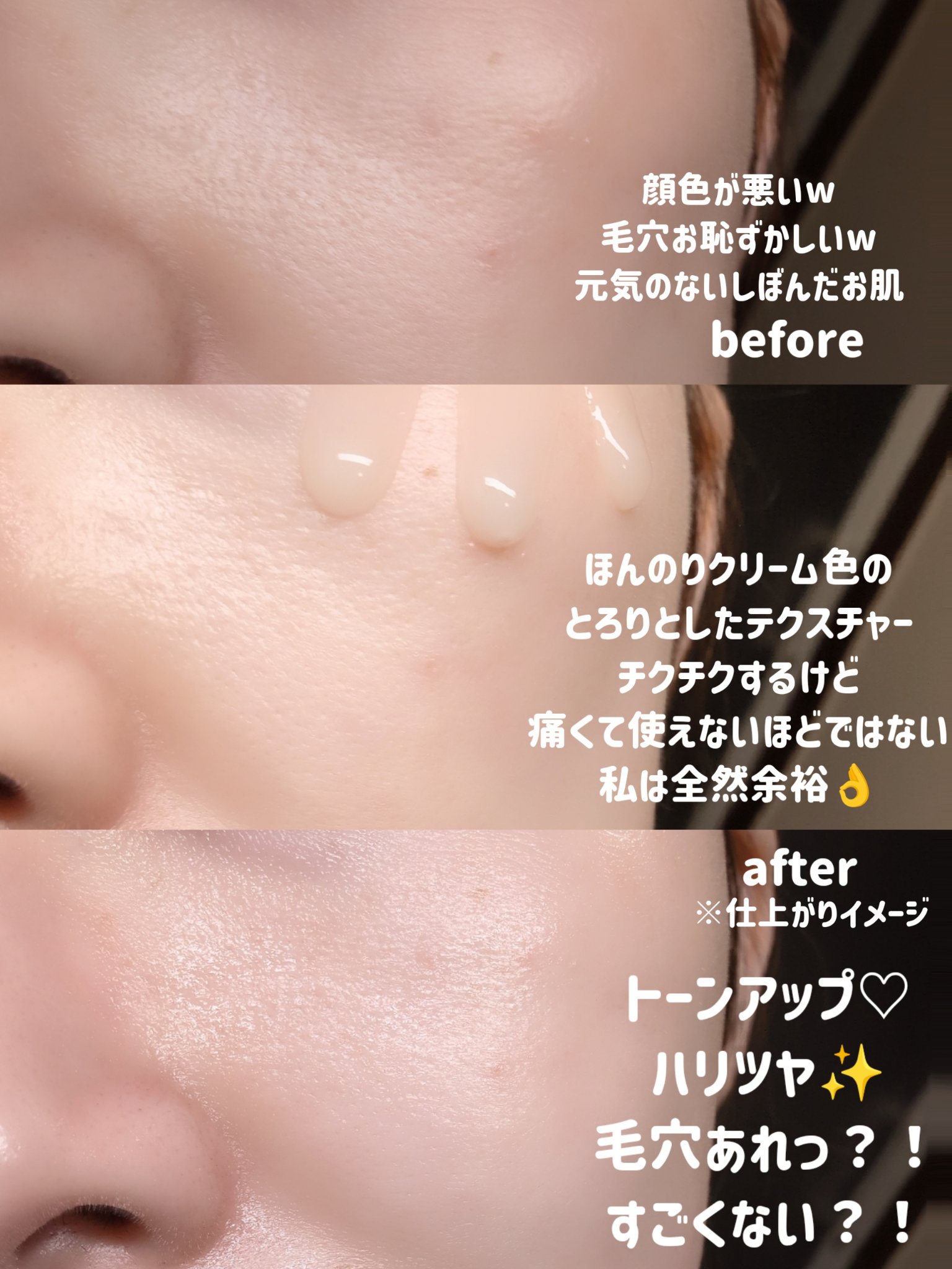 PDRNショット675/COSNORI/美容液を使ったクチコミ（3枚目）