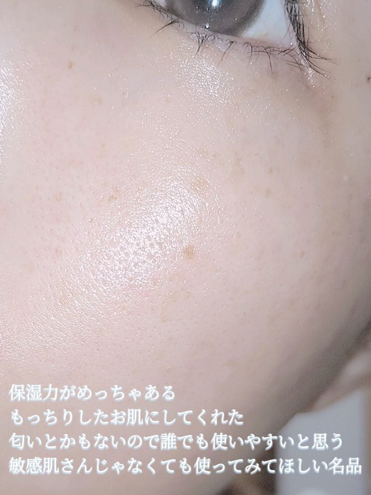 アレルバリア ミスト/d プログラム/ミスト状化粧水を使ったクチコミ(6枚目)