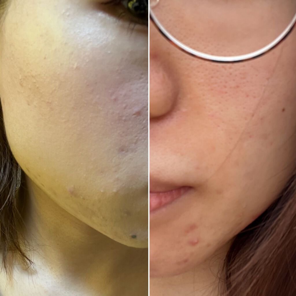 マスクフィットクッション/TIRTIR(ティルティル)/クッションファンデーションを使ったクチコミ(2枚目)