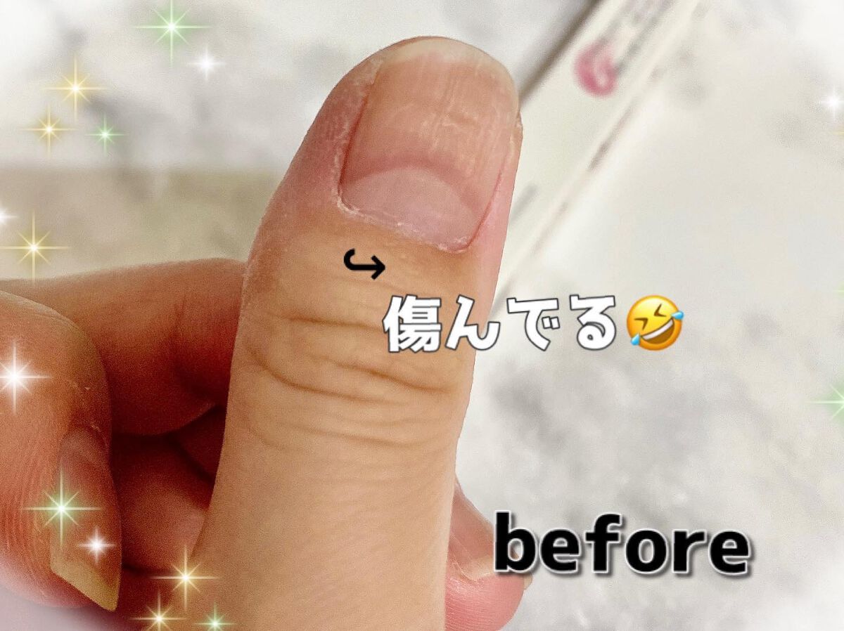 ルミナスネイルエッセンス/Dear.A/ネイルオイル・トリートメントを使ったクチコミ(2枚目)