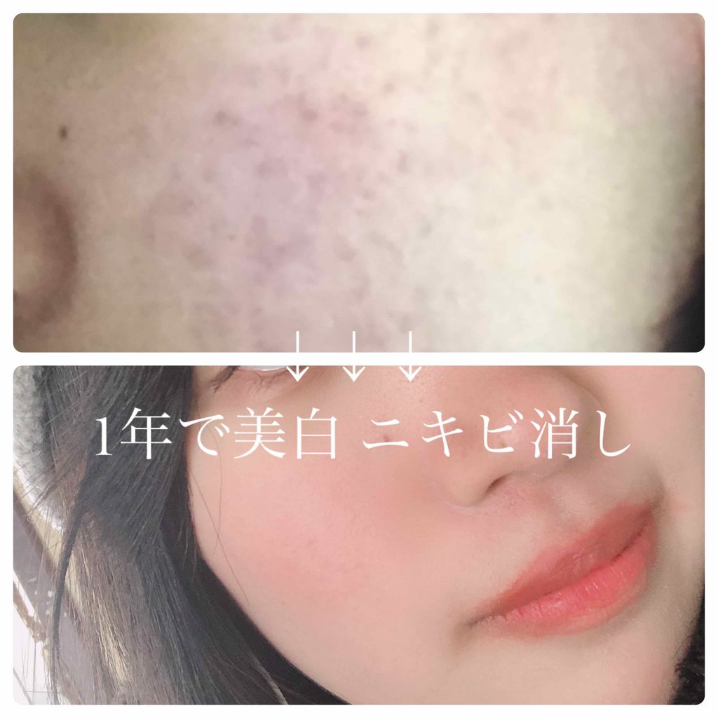 ハトムギ化粧水(ナチュリエ スキンコンディショナー R )/ナチュリエ/化粧水を使ったクチコミ（1枚目）