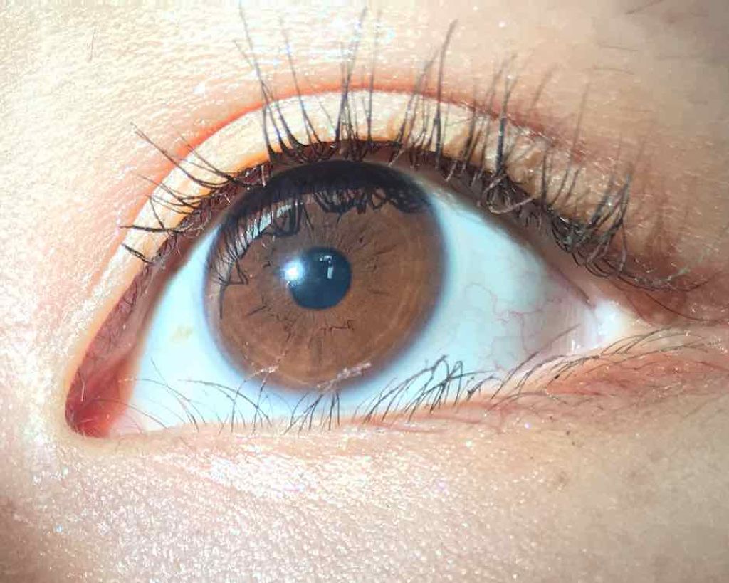 あらきは後頭部ハゲ on LIPS 「⚠️2枚目以降目のどアップ画像苦手な方ごめんなさい🙇♀️こん..」(3枚目)