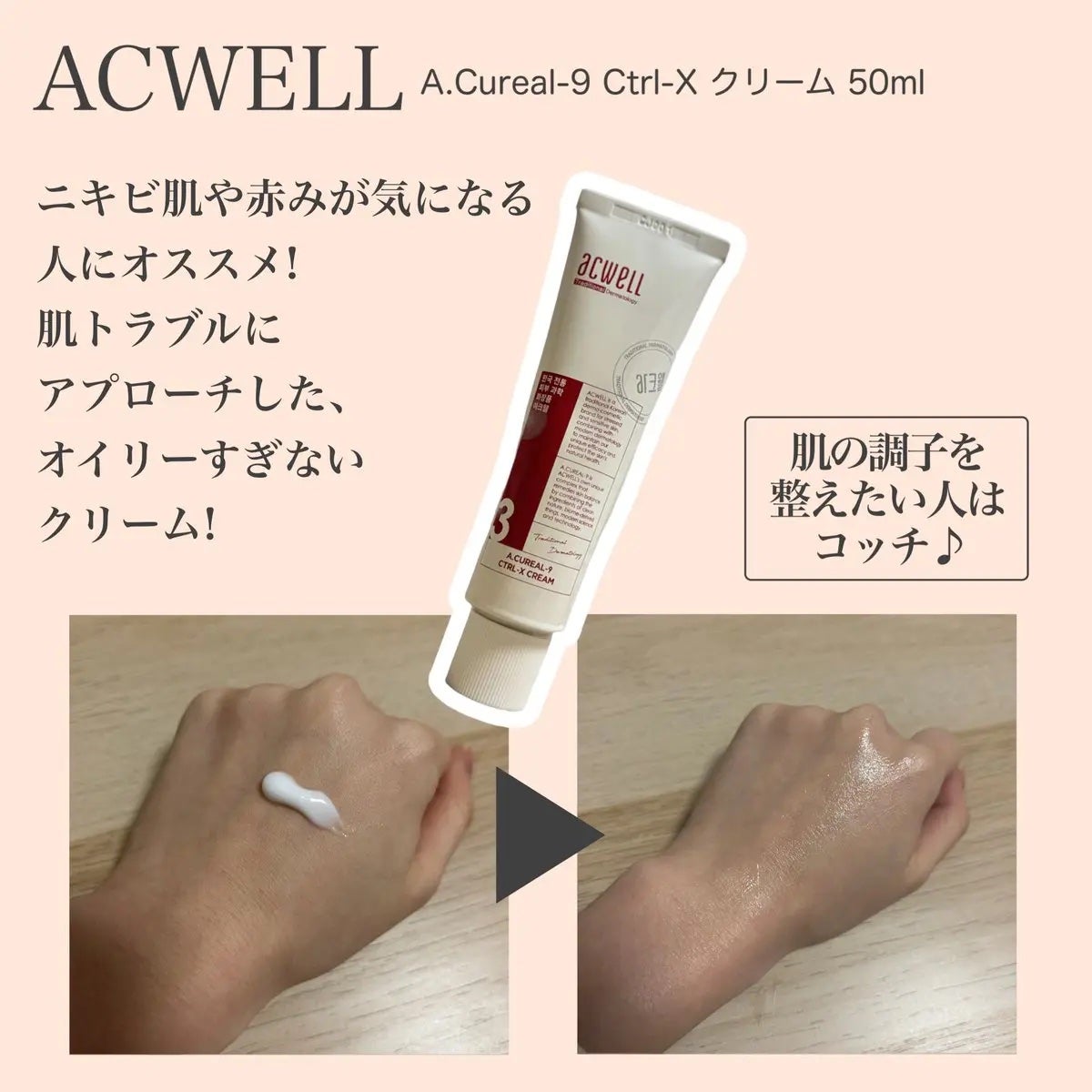 アキュリアルナインコントロールエックスクリーム/ACWELL/フェイスクリームを使ったクチコミ(3枚目)