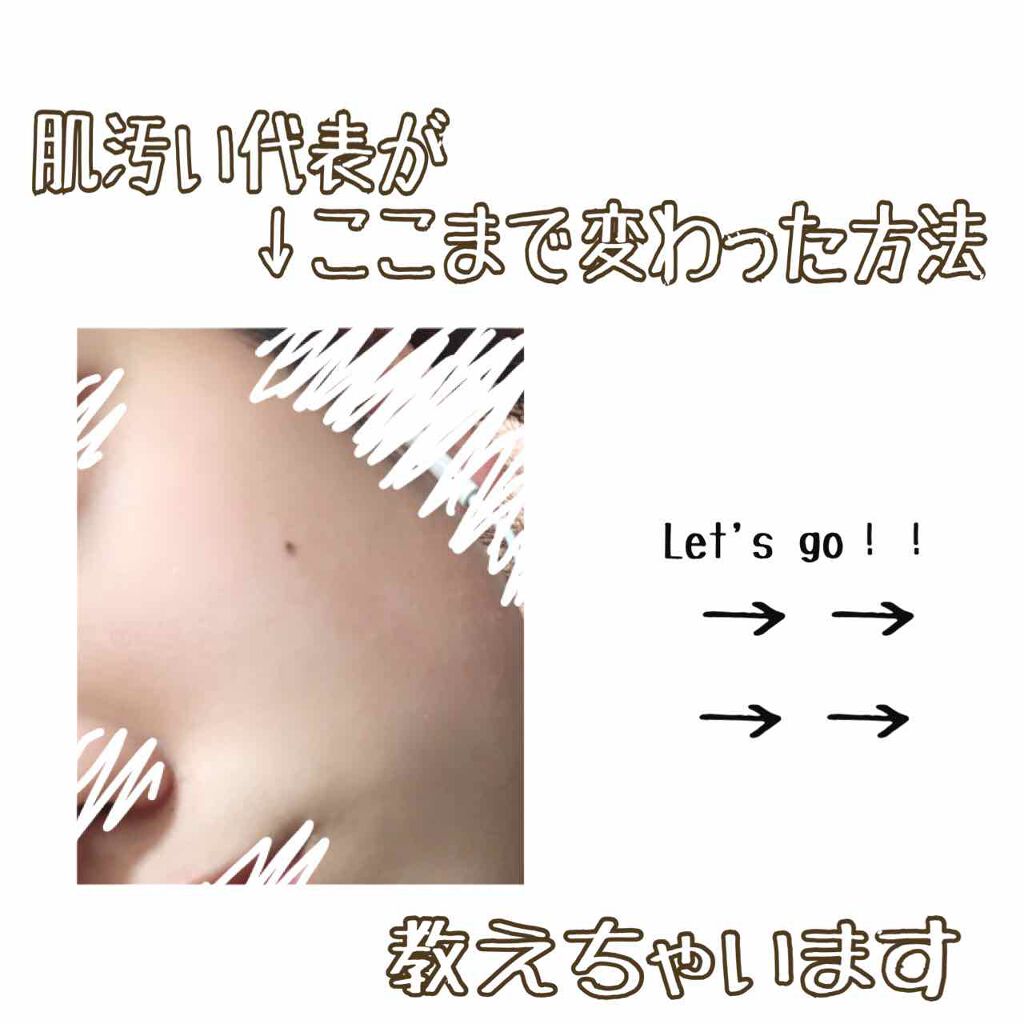 ニベアクリーム/ニベア/ボディクリームを使ったクチコミ（1枚目）