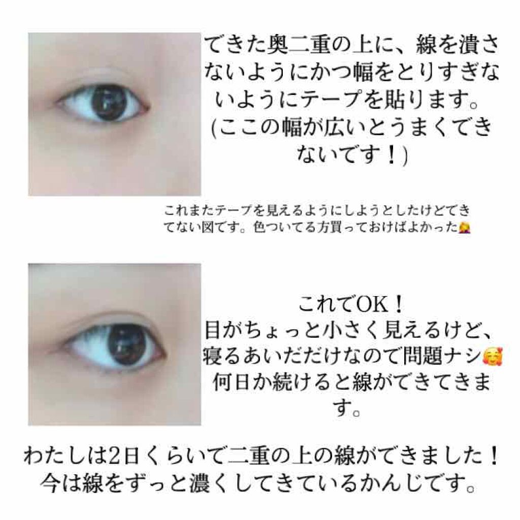 しなやかフィット/DAISO/二重まぶた用アイテムを使ったクチコミ（3枚目）