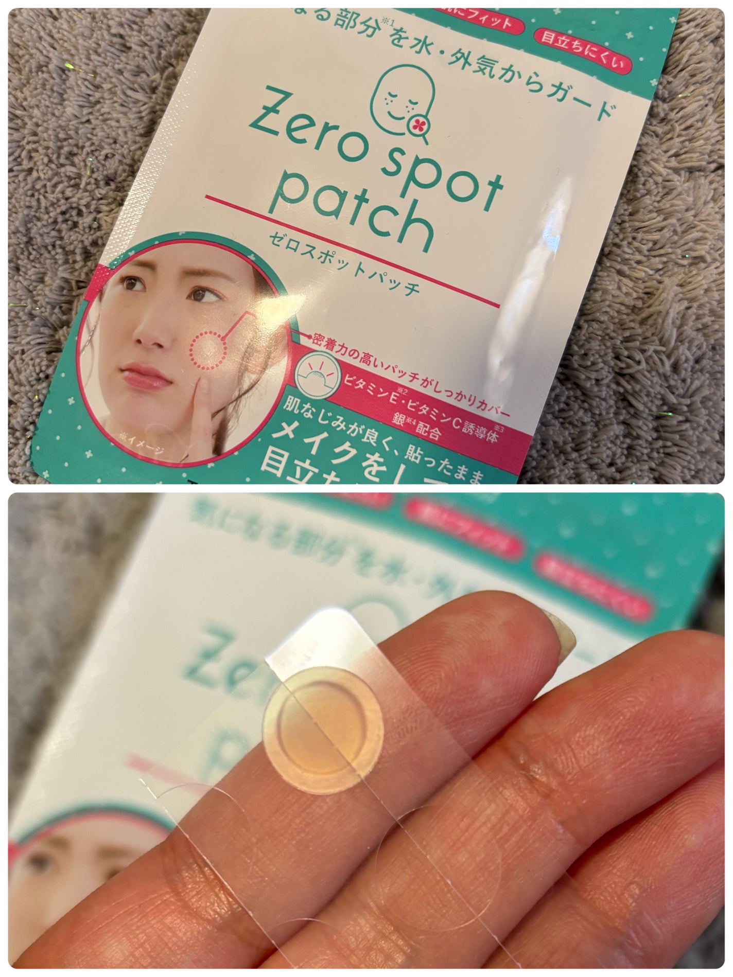ゼロスポットパッチ/Today’s Cosme/にきびパッチを使ったクチコミ(1枚目)