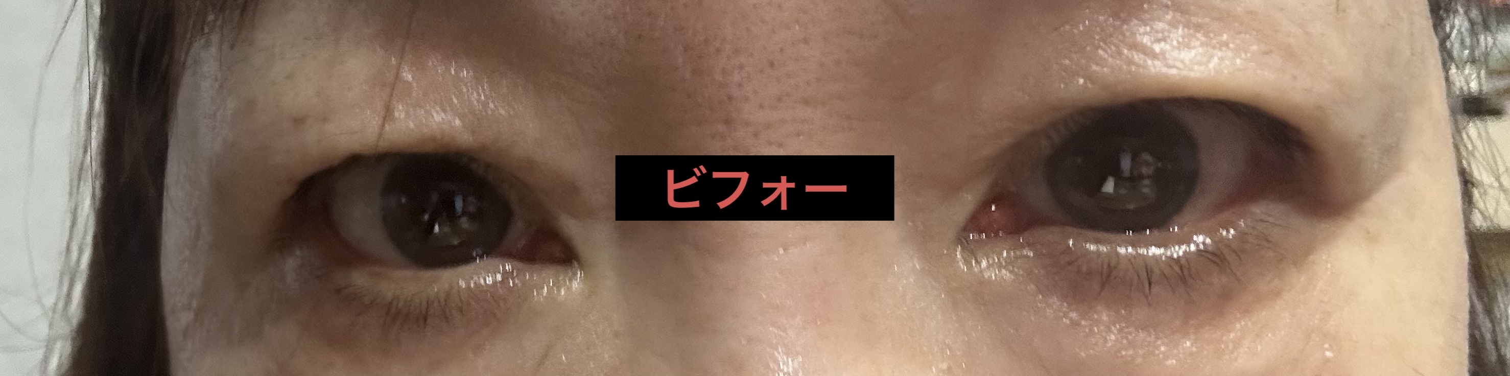 TWOOL ダブルアイリッドグルー ダブルアイリッドグルー 接着タイプ/SHOBIDO/二重まぶた用アイテムを使ったクチコミ（2枚目）