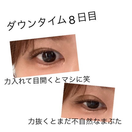 DHC メリロート/DHC/ボディサプリメントを使ったクチコミ(1枚目)