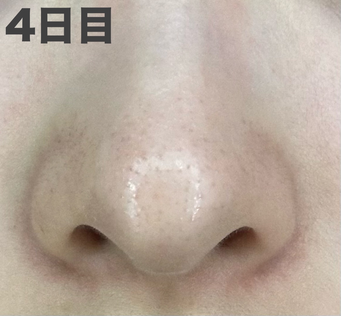 おうちdeエステ 肌をなめらかにするマッサージ洗顔ジェル 炭/ビオレ/その他洗顔料を使ったクチコミ（2枚目）