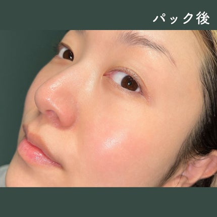 ルルルンプレシャス WHITE(クリア)【旧】/ルルルン/シートマスク・パックを使ったクチコミ(5枚目)