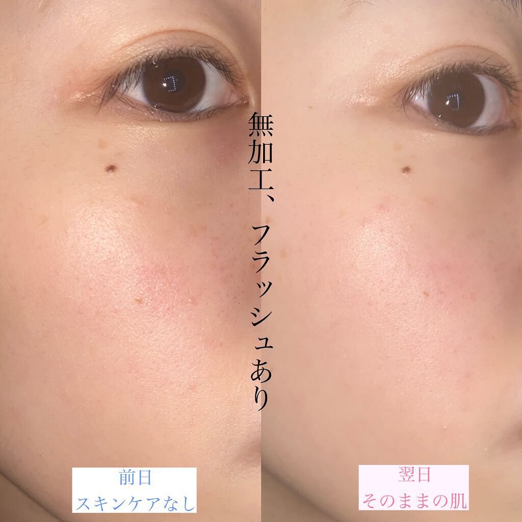 ドクダミ 77 スージングトナー/Anua/化粧水を使ったクチコミ(5枚目)