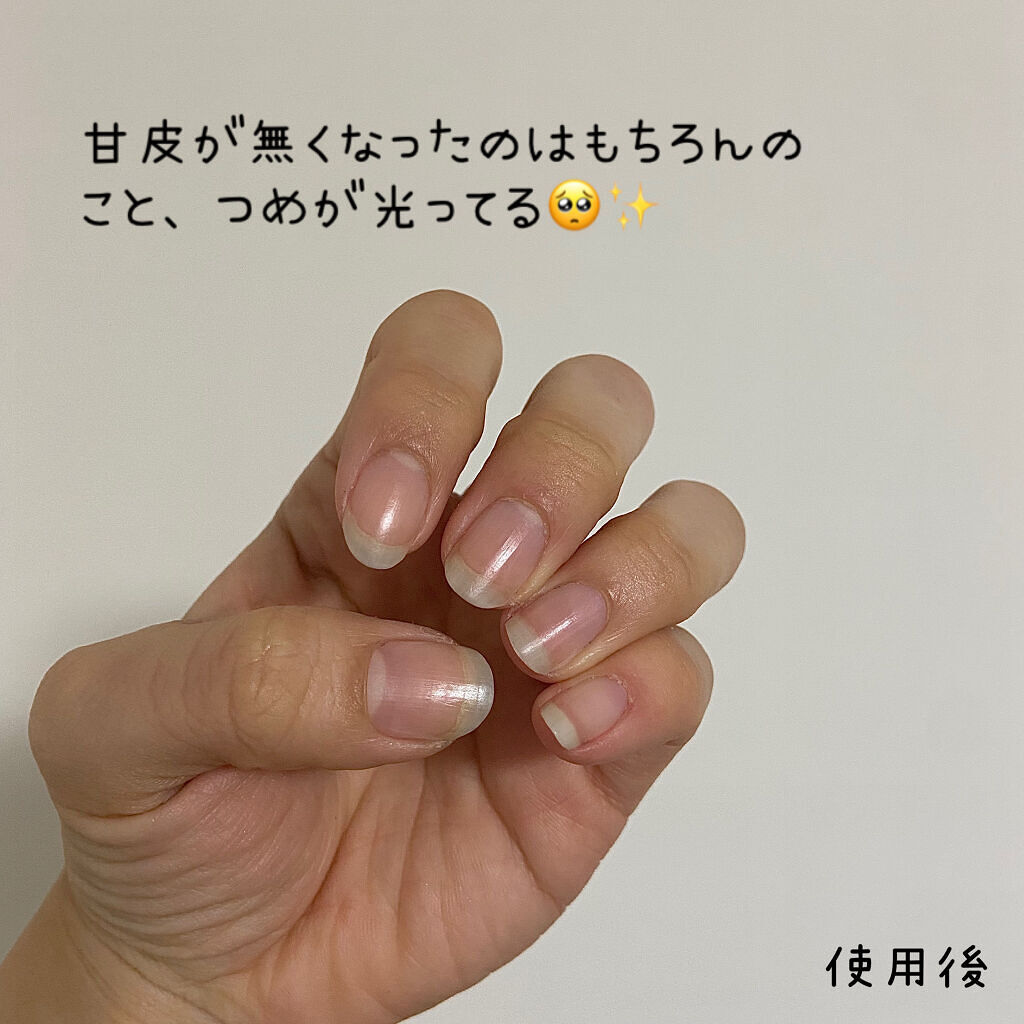 オイルインキューティクルプッシャーペン/ビューティーワールド/ネイル用品を使ったクチコミ（3枚目）