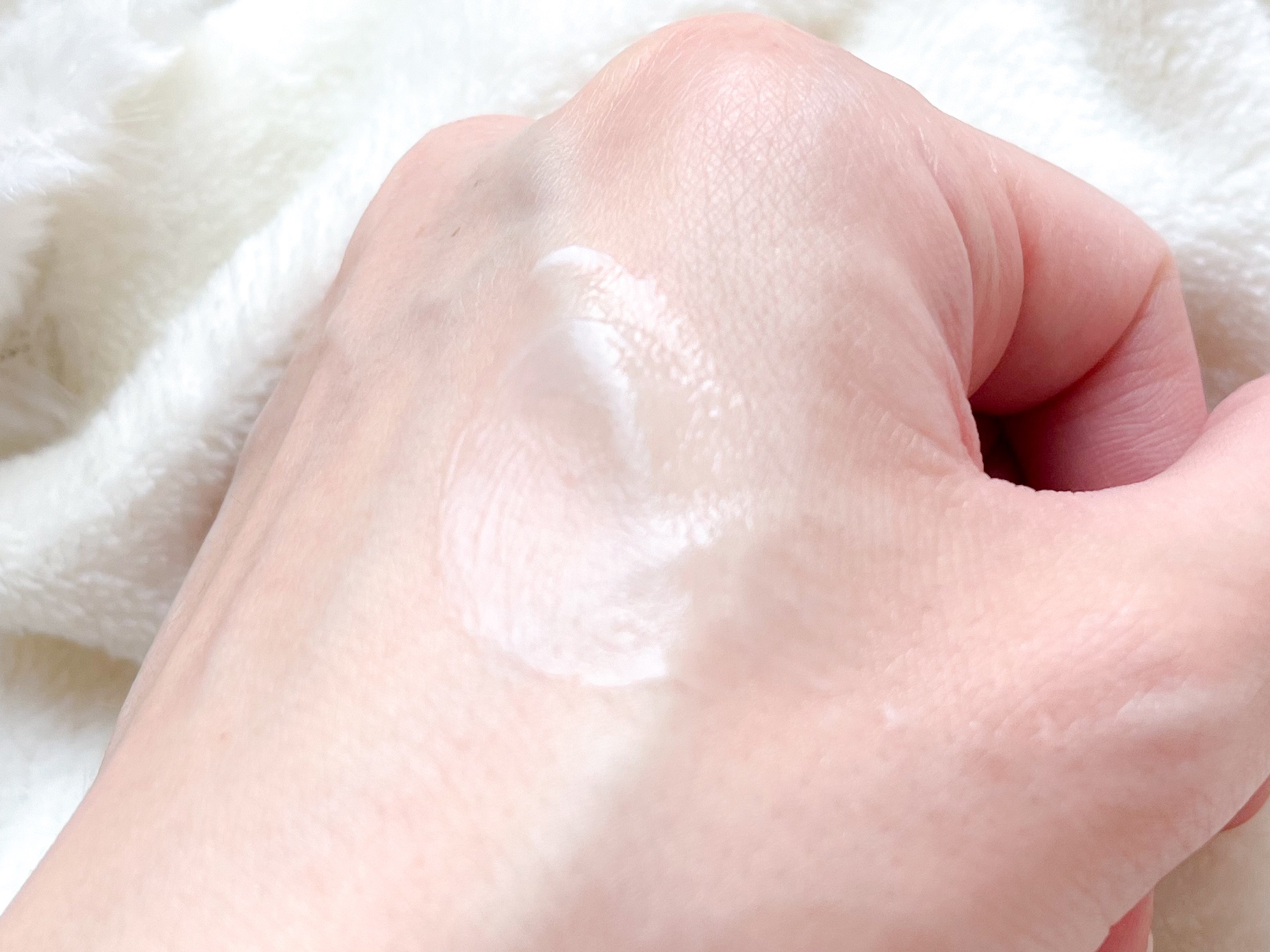 メディダーマ ニードルポアセラム800/メディダーマ/美容液を使ったクチコミ（3枚目）