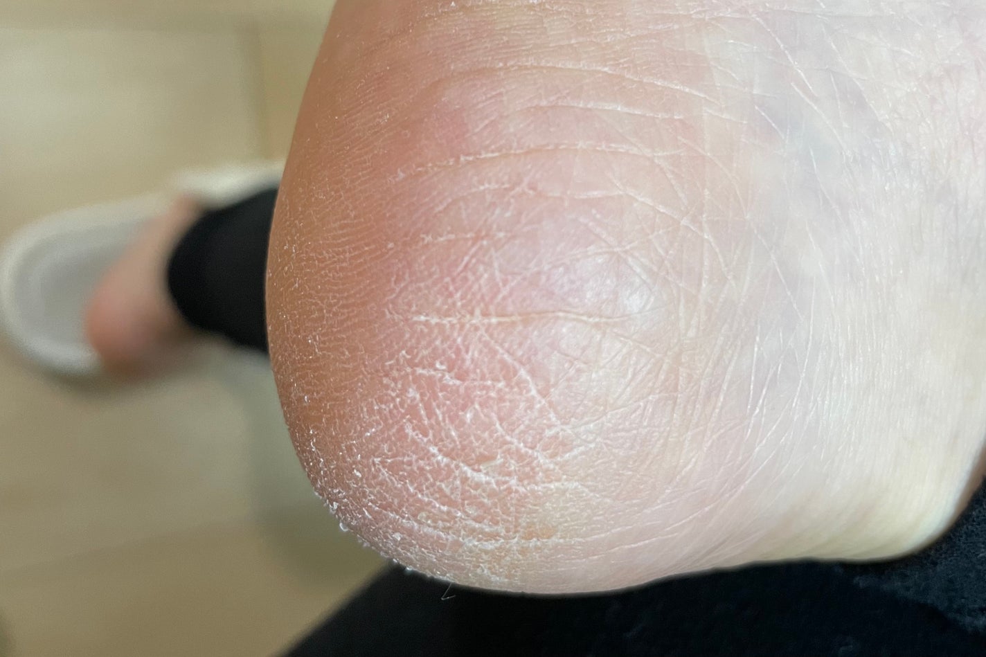 キープアシークレット/ROAlív/美容液を使ったクチコミ(4枚目)