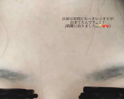 明色美顔水 薬用化粧水/美顔/化粧水を使ったクチコミ(2枚目)