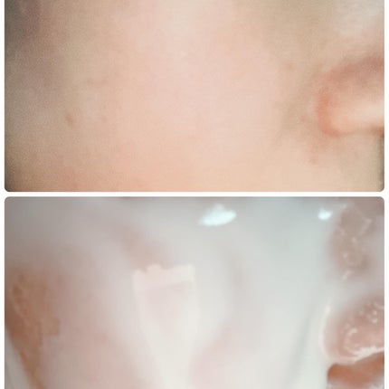 ドクダミ化粧水/ONE THING/化粧水を使ったクチコミ(5枚目)