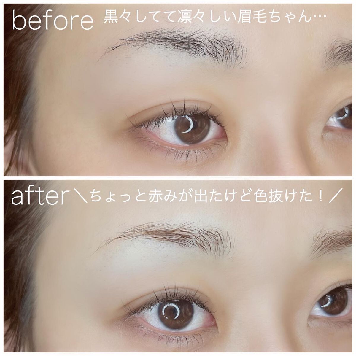 ジョレン クリーム ブリーチ/ジョレンジャパン/ムダ毛ケアを使ったクチコミ(6枚目)