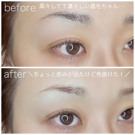 ジョレン クリーム ブリーチ/ジョレンジャパン/ムダ毛ケアを使ったクチコミ(6枚目)