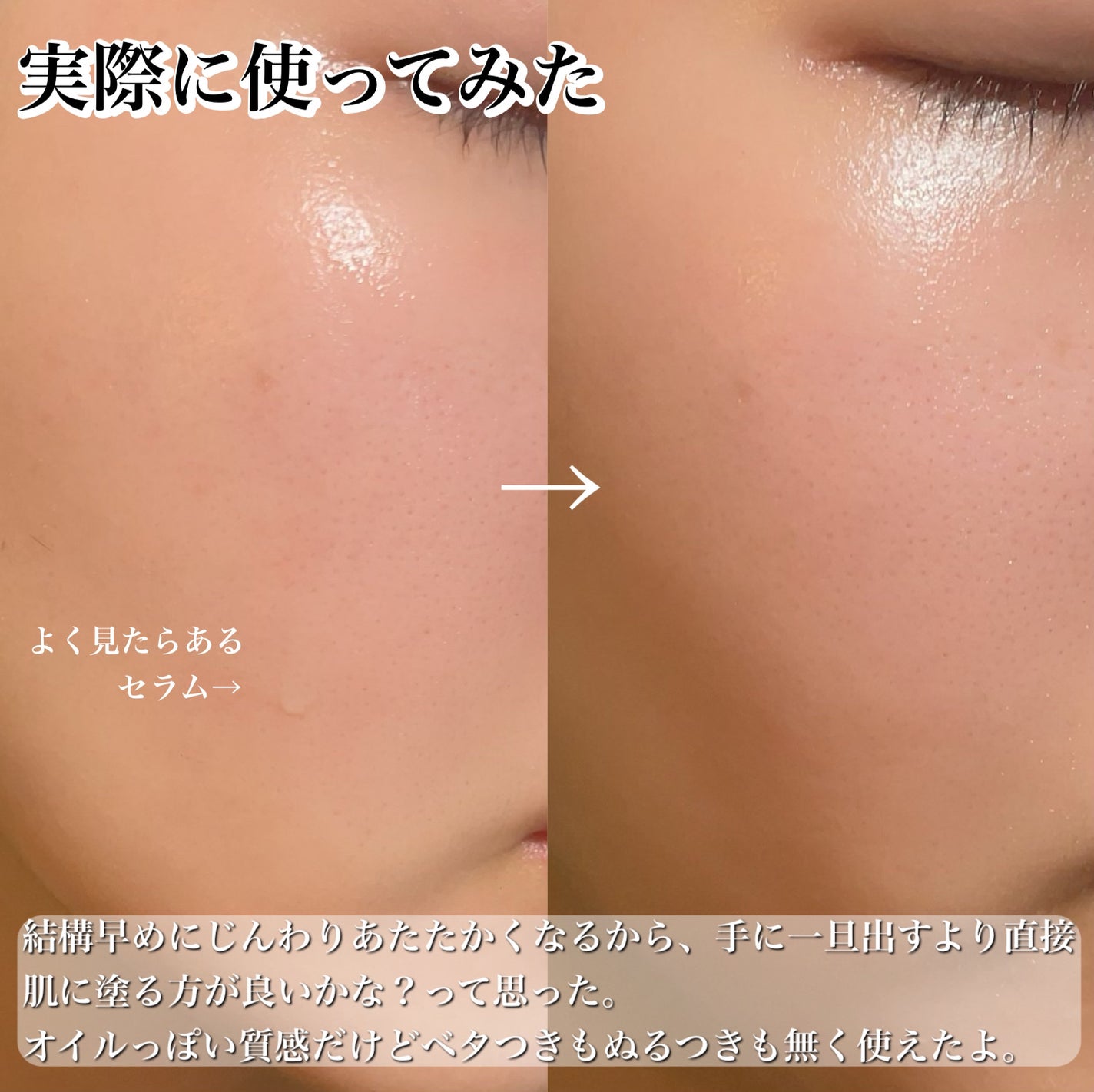 フレッシュリージュースドビタミンドロップ(35ml)/Klairs/美容液を使ったクチコミ(6枚目)