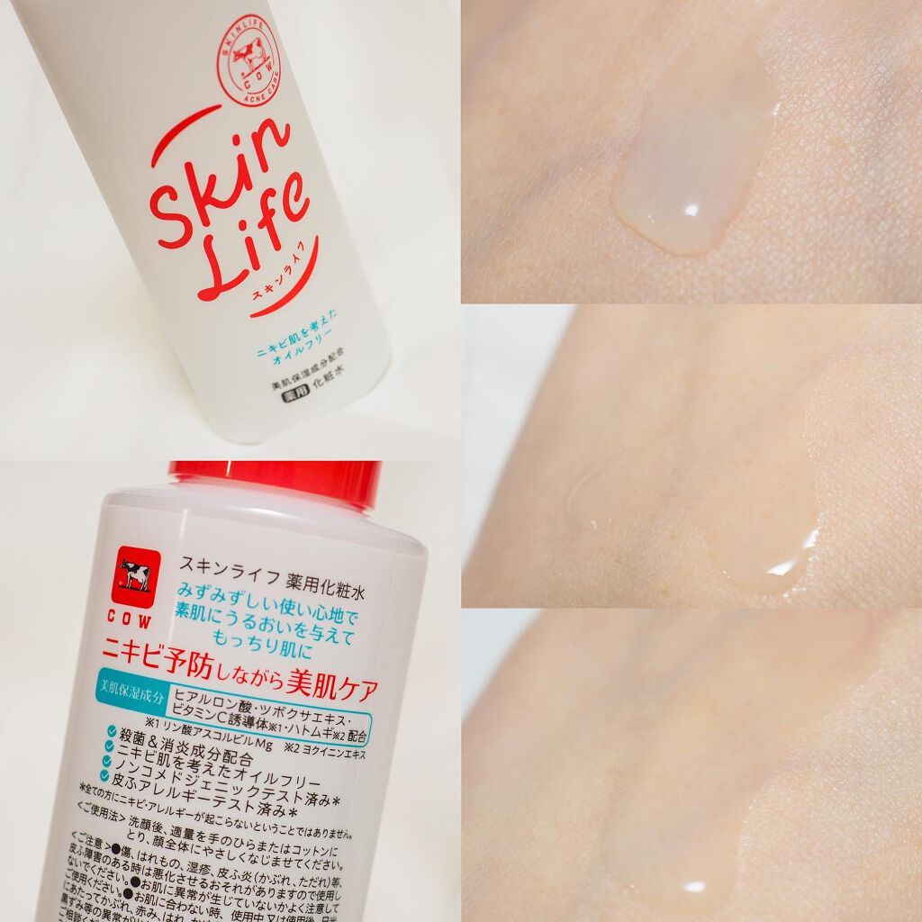 薬用化粧水/スキンライフ/化粧水を使ったクチコミ（2枚目）