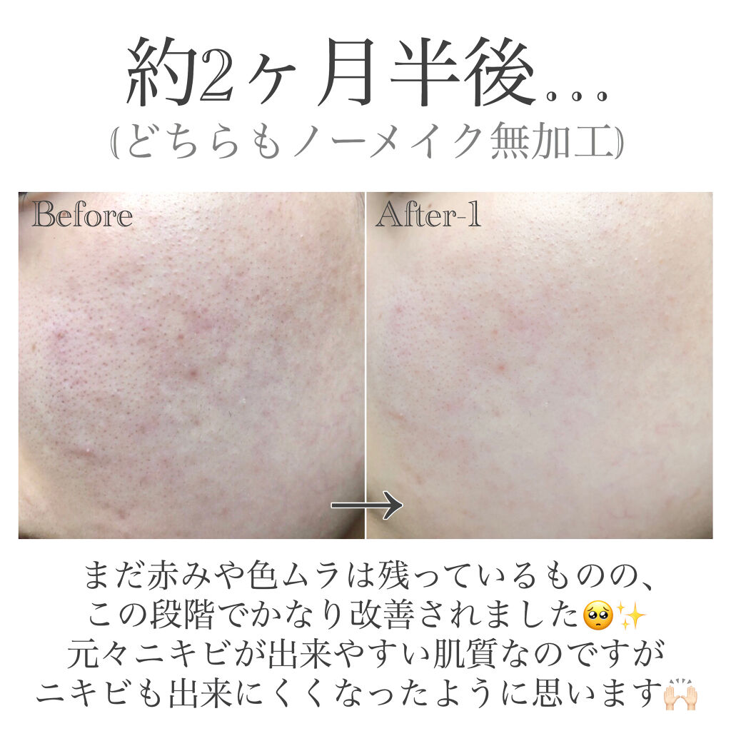 クリアブライト ローション/シュープリームノイ/化粧水を使ったクチコミ（3枚目）