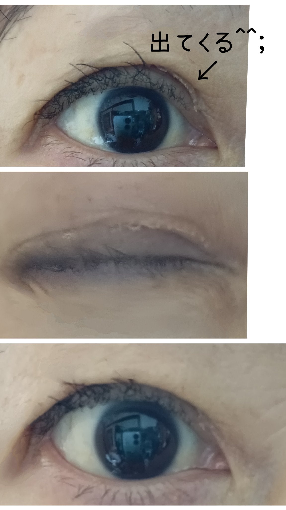 メッシュアイテープ/DAISO/二重まぶた用アイテムを使ったクチコミ(4枚目)