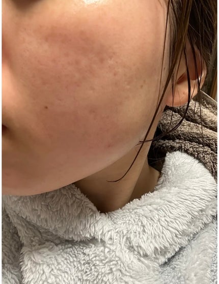 明色美顔水 薬用化粧水/美顔/化粧水を使ったクチコミ(3枚目)