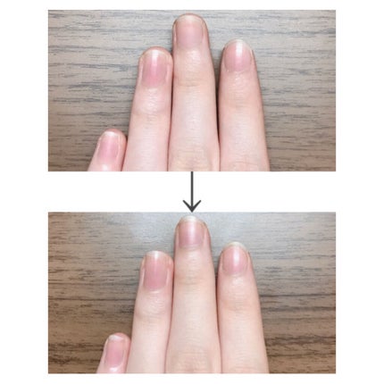 キューティクルオイル/ネイルホリック/ネイルオイル・トリートメントを使ったクチコミ(4枚目)