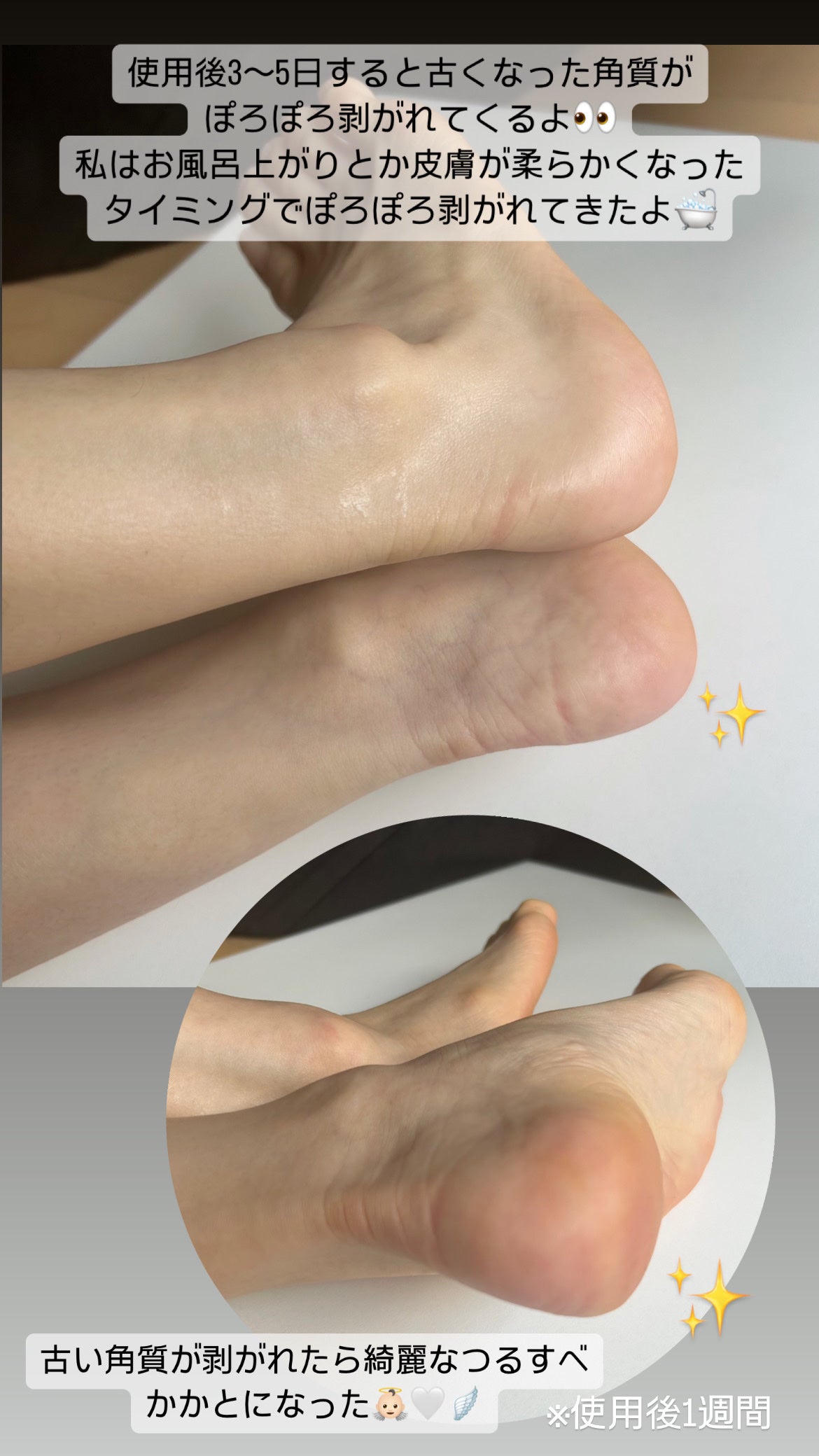 かかとピーリングマスク/ドクター・ショール/レッグ・フットケアを使ったクチコミ(9枚目)