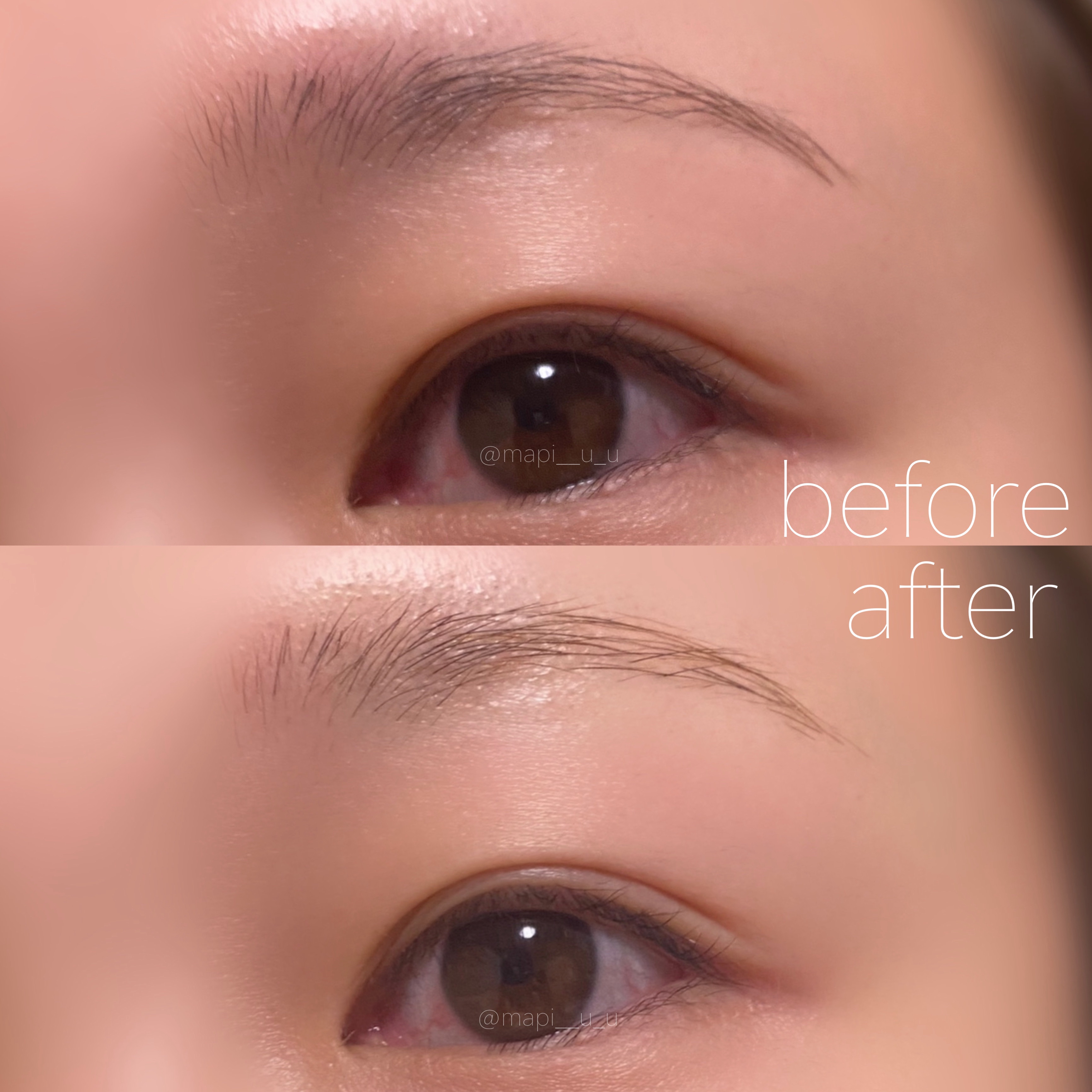 脱色クリーム 敏感肌用/エピラット/ムダ毛ケアを使ったクチコミ（2枚目）