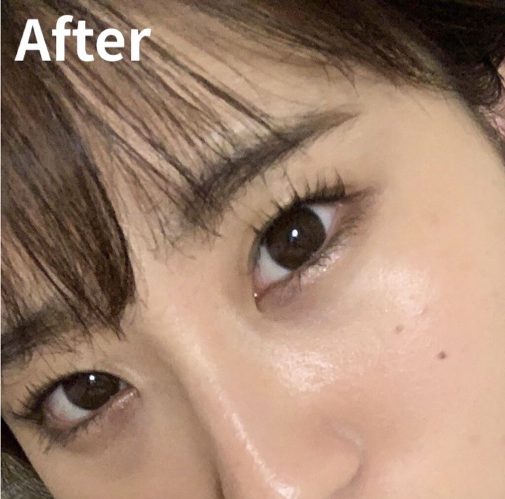 コラーゲンピーリングジェル/旅美人/ピーリングを使ったクチコミ（1枚目）