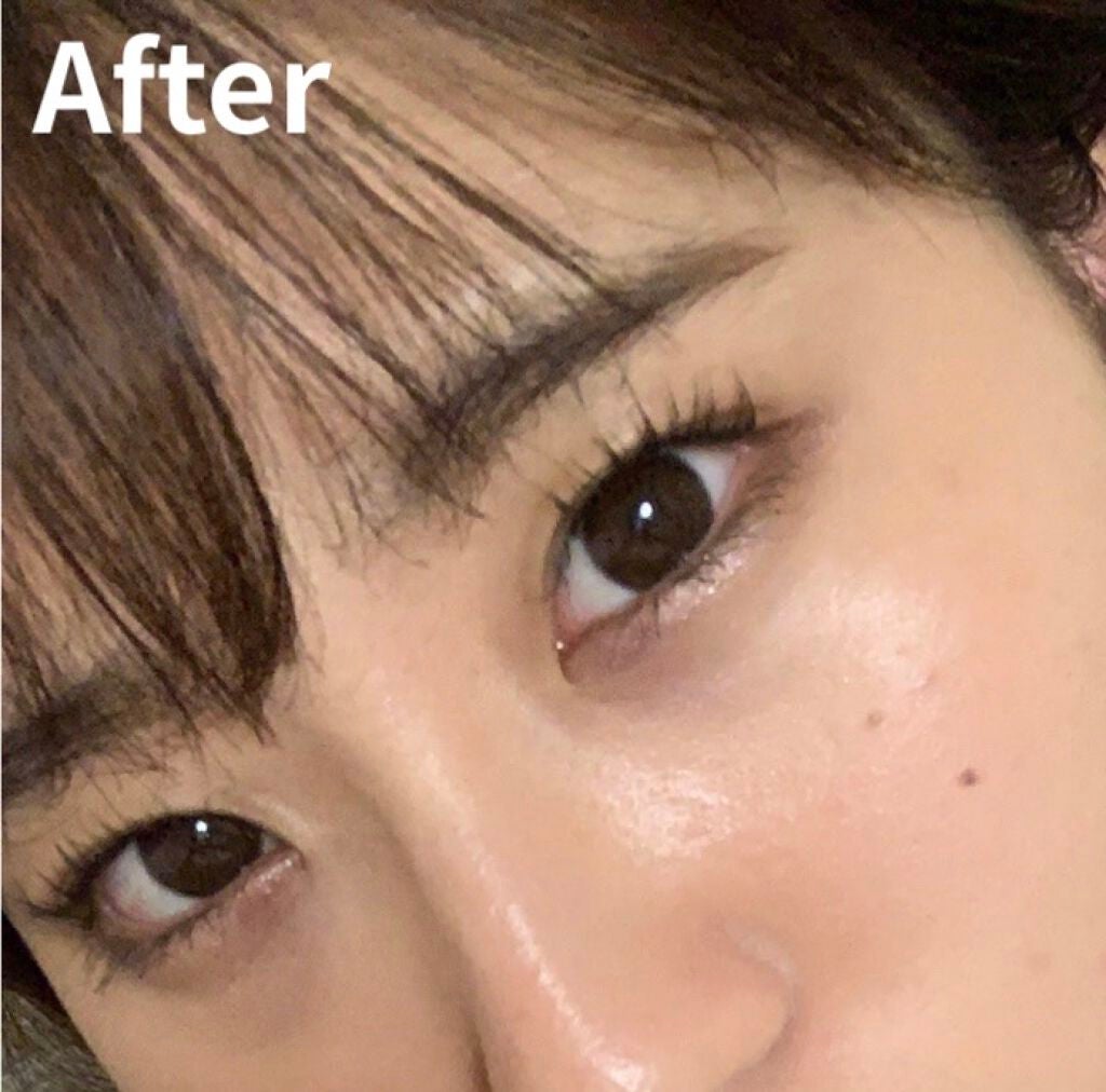 コラーゲンピーリングジェル/旅美人/ピーリングを使ったクチコミ(1枚目)