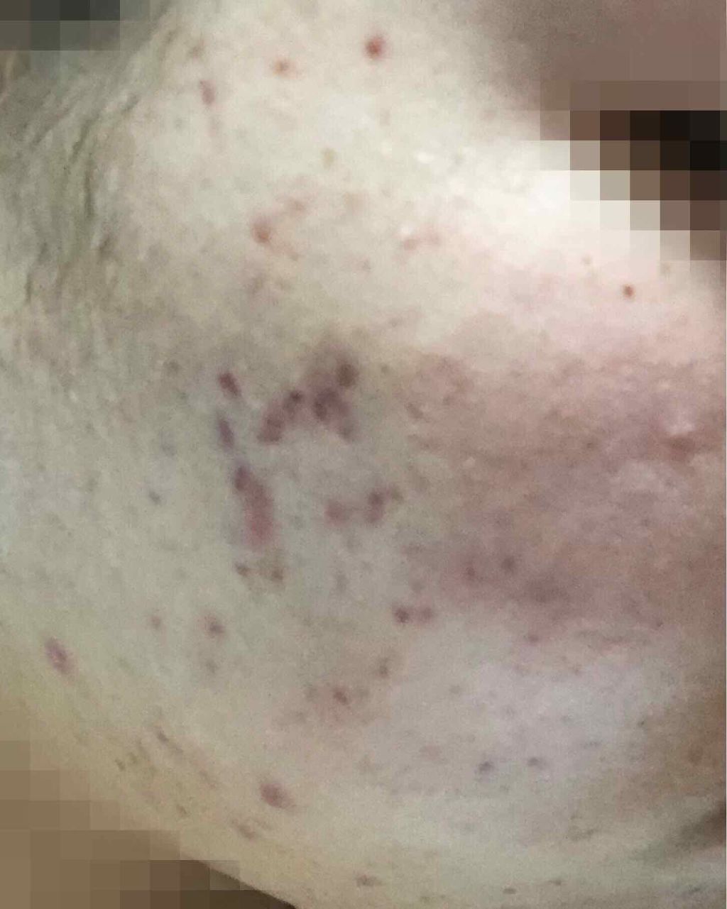 ミルク on LIPS 「【閲覧注意】見て後悔しても知りません🙅♀️最初に言っときます..」(2枚目)