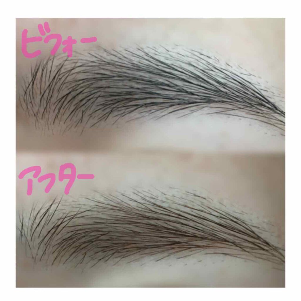 脱色クリーム 敏感肌用/エピラット/ムダ毛ケアを使ったクチコミ（2枚目）