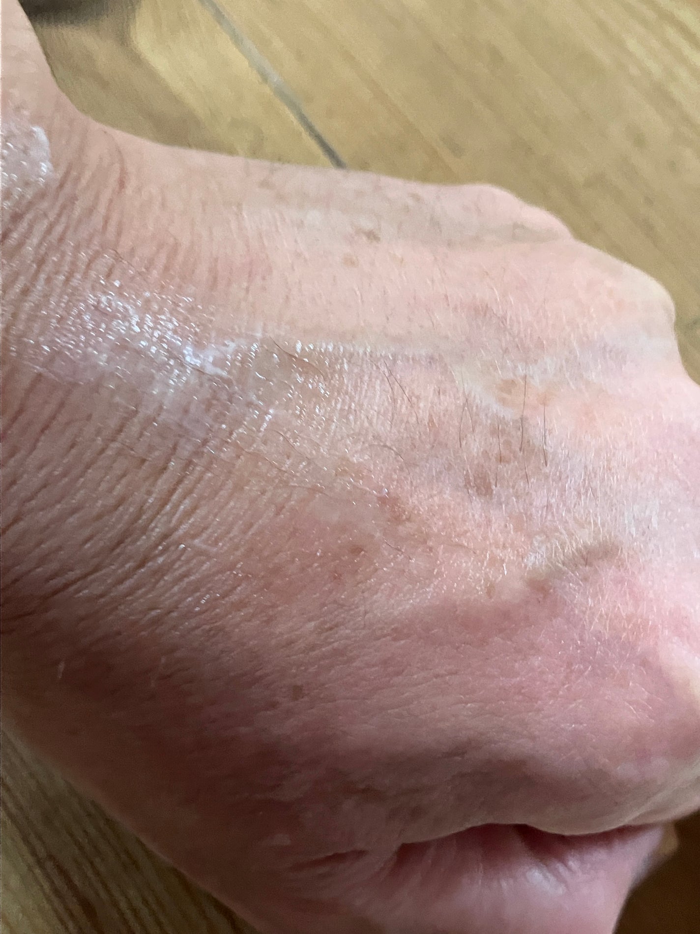 インティメイト ブライトニングクリーム/Waphyto/デリケートゾーンケアを使ったクチコミ(4枚目)