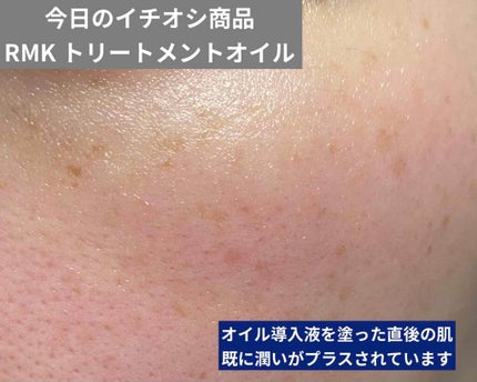 RMK Wトリートメントオイル/RMK/ブースター・導入液を使ったクチコミ(3枚目)
